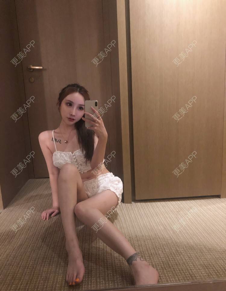 更美 - MeYou00的自体脂肪丰苹果肌经验 | 自体脂肪丰苹果肌 | 自体脂肪全面部填充 | 视频日记 | 自体脂肪丰面颊 | 自体脂肪丰太阳穴 | 杭州 | 自体脂肪丰额头