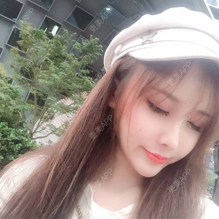 更美 - MeYou00的自体脂肪丰苹果肌经验 | 自体脂肪丰苹果肌 | 自体脂肪全面部填充 | 视频日记 | 自体脂肪丰面颊 | 自体脂肪丰太阳穴 | 杭州 | 自体脂肪丰额头