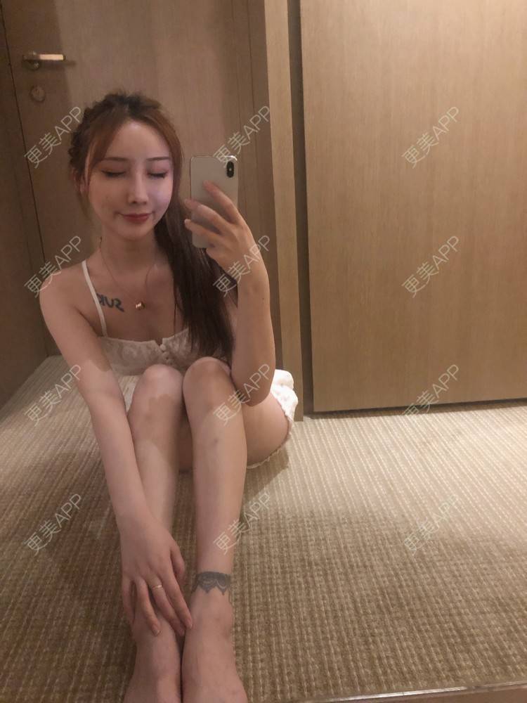 更美 - MeYou00的自体脂肪丰苹果肌经验 | 自体脂肪丰苹果肌 | 自体脂肪全面部填充 | 视频日记 | 自体脂肪丰面颊 | 自体脂肪丰太阳穴 | 杭州 | 自体脂肪丰额头