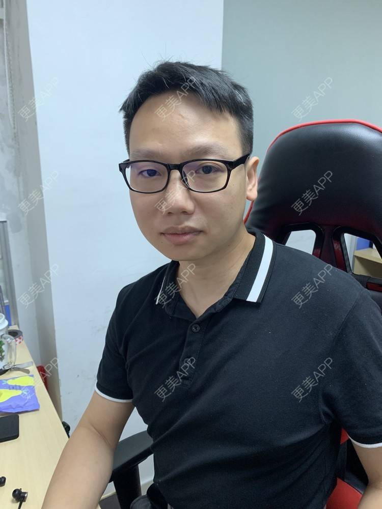 更美 - 更美用户5GgscumMag的放射状角膜切开术经验 | 准分子激光切削术 | 半飞秒激光术 | 全飞秒激光术 | 放射状角膜切开术 | ICL晶体植入 | 深圳