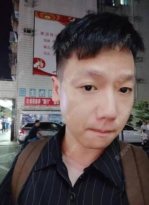 更美 - 更美用户5GgscumMag的放射状角膜切开术经验 | 全飞秒激光术 | 半飞秒激光术 | ICL晶体植入 | 准分子激光切削术 | 放射状角膜切开术 | 深圳