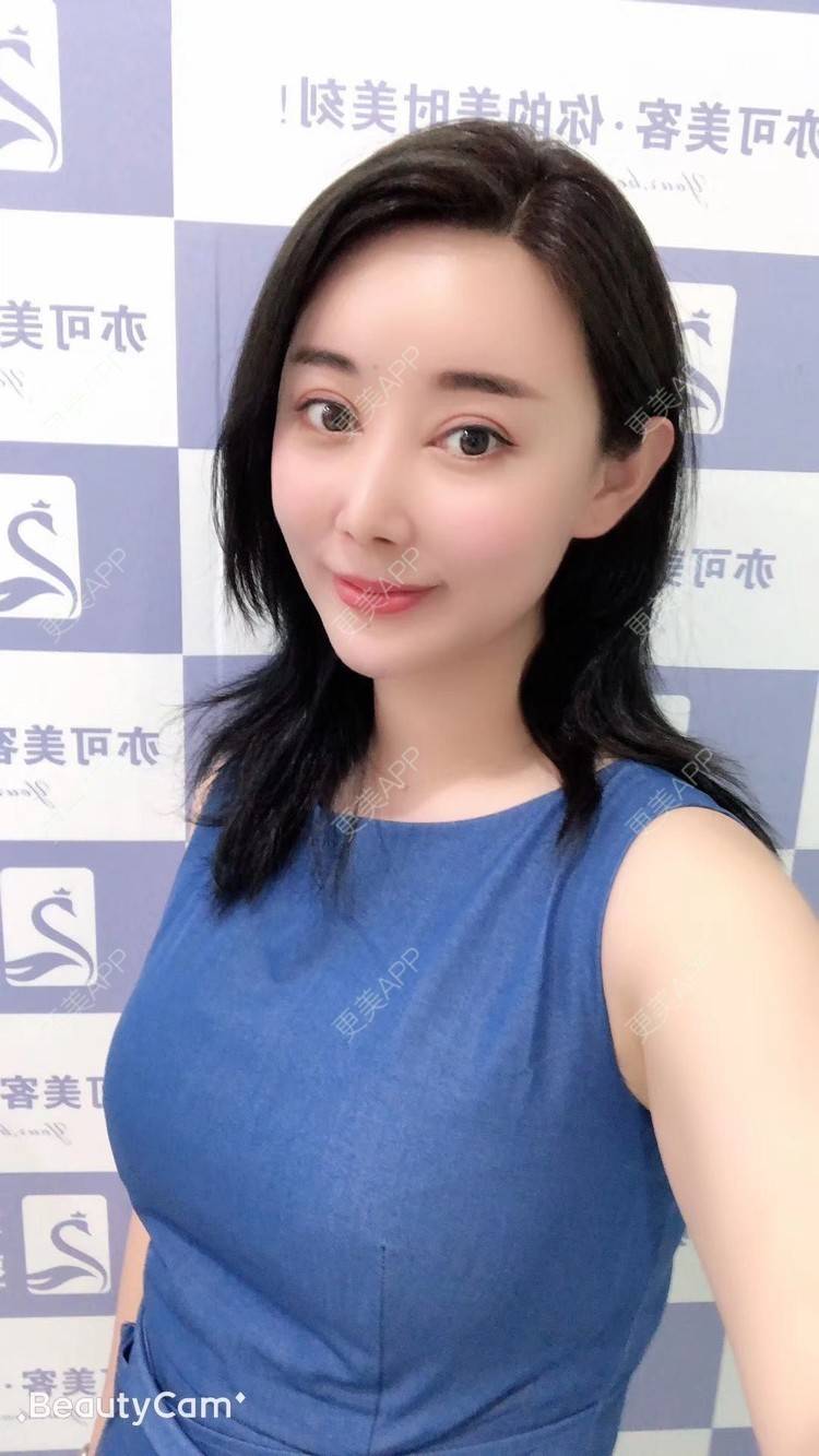 更美 - 狐狸仙儿的自体脂肪隆鼻经验 | 鼻中隔软骨隆鼻 | 胶原蛋白隆鼻 | 硅胶隆鼻 | 肋软骨隆鼻 | 自体脂肪隆鼻