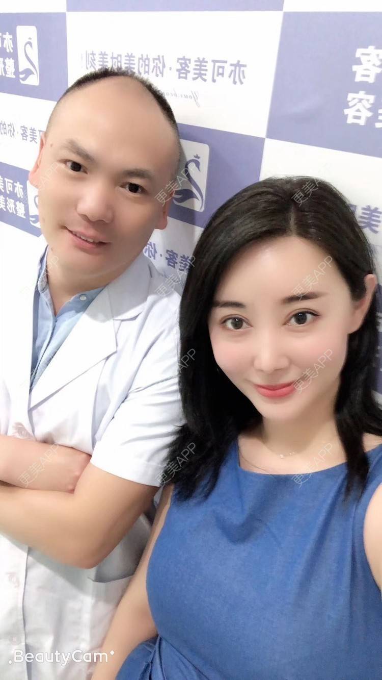 更美 - 狐狸仙儿的自体脂肪隆鼻经验 | 鼻中隔软骨隆鼻 | 胶原蛋白隆鼻 | 硅胶隆鼻 | 肋软骨隆鼻 | 自体脂肪隆鼻