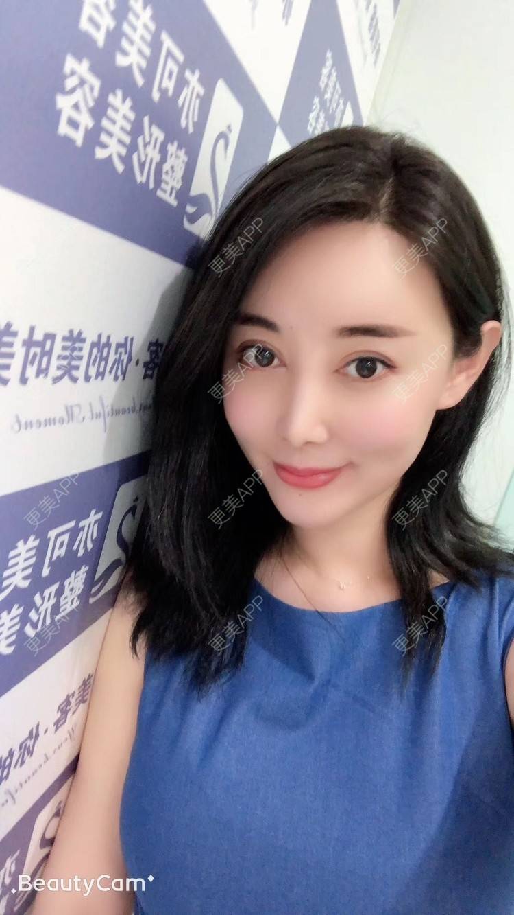 更美 - 狐狸仙儿的自体脂肪隆鼻经验 | 鼻中隔软骨隆鼻 | 胶原蛋白隆鼻 | 硅胶隆鼻 | 肋软骨隆鼻 | 自体脂肪隆鼻