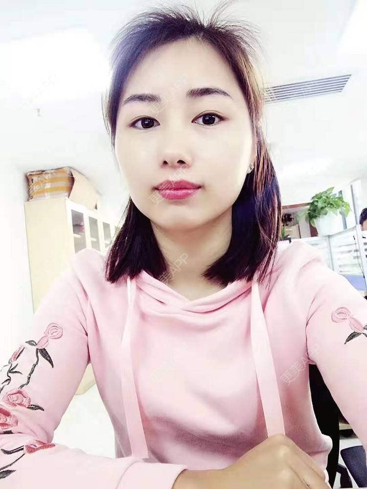 更美 - 更美用户wOIo91bqM0的准分子激光切削术经验 | 全飞秒激光术 | 半飞秒激光术 | 准分子激光切削术 | ICL晶体植入 | 准分子激光原位角膜磨镶术 | 深圳