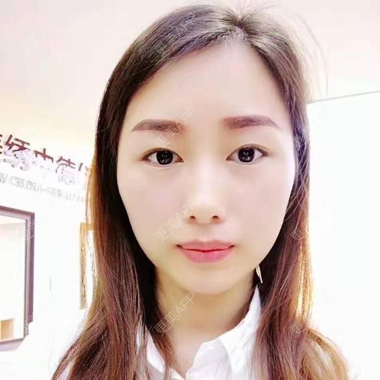 更美 - 更美用户wOIo91bqM0的准分子激光切削术经验 | 全飞秒激光术 | 半飞秒激光术 | 准分子激光切削术 | ICL晶体植入 | 准分子激光原位角膜磨镶术 | 深圳