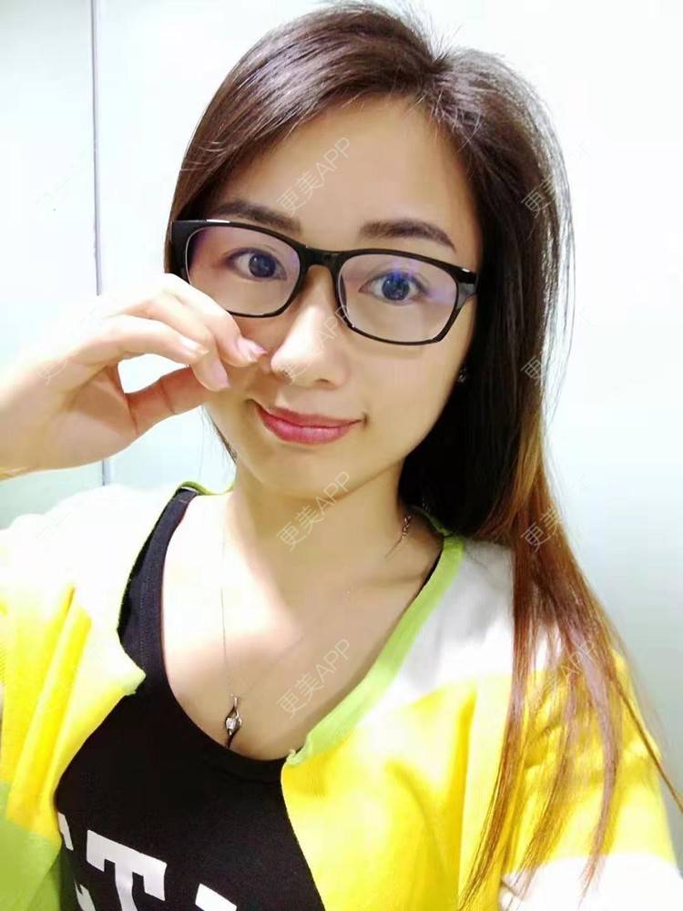 更美 - 更美用户wOIo91bqM0的准分子激光切削术经验 | 全飞秒激光术 | 半飞秒激光术 | 准分子激光切削术 | ICL晶体植入 | 准分子激光原位角膜磨镶术 | 深圳