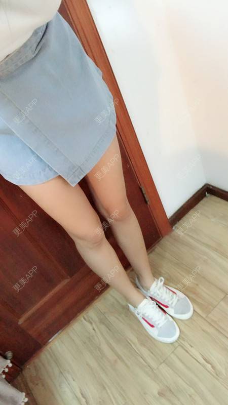 更美 - 我是一个小瘦子的腰腹吸脂日记 | 腿部塑形 | 吸脂瘦大腿