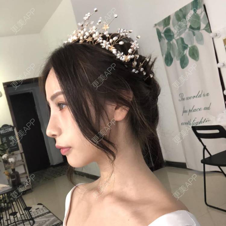 更美 - 李现的现女友的歪鼻矫正经验 | 重庆 | 肋软骨隆鼻 | 鼻孔矫正 | 歪鼻矫正 | 鼻翼缩小