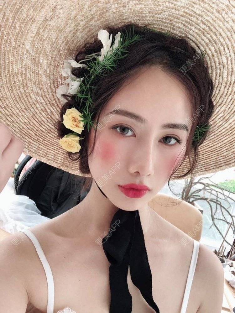 更美 - 李现的现女友的歪鼻矫正经验 | 重庆 | 肋软骨隆鼻 | 鼻孔矫正 | 歪鼻矫正 | 鼻翼缩小
