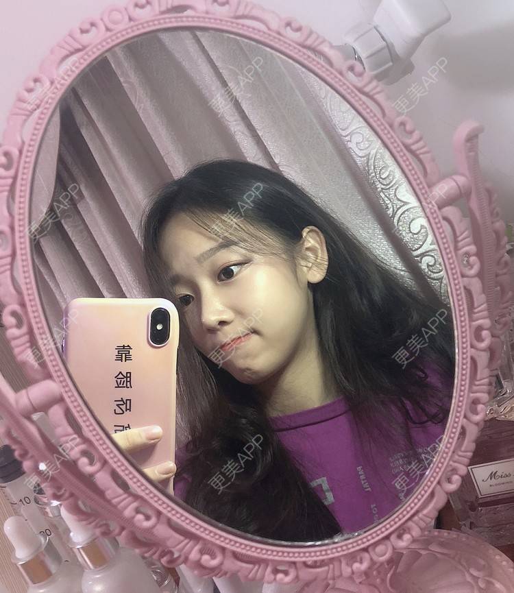 更美 - 本仙女不是妖🧚的鼻部多项经验 | 鼻部多项 | 鼻部综合 | 鼻部修复 | 鼻部膨体假体取出 | 手术缩鼻头 | 鼻翼缩小 | 广州 | 鼻中隔软骨垫鼻头 | 鼻孔矫正 | 鼻基底 | 鼻小柱缩短 | 自体肋软骨垫鼻基底
