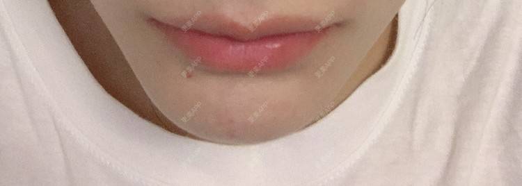 更美 - 更美小透明🍬的经验 | 杭州