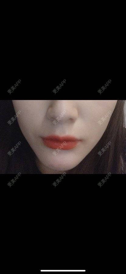 更美 - 更美小透明🍬的经验 | 杭州