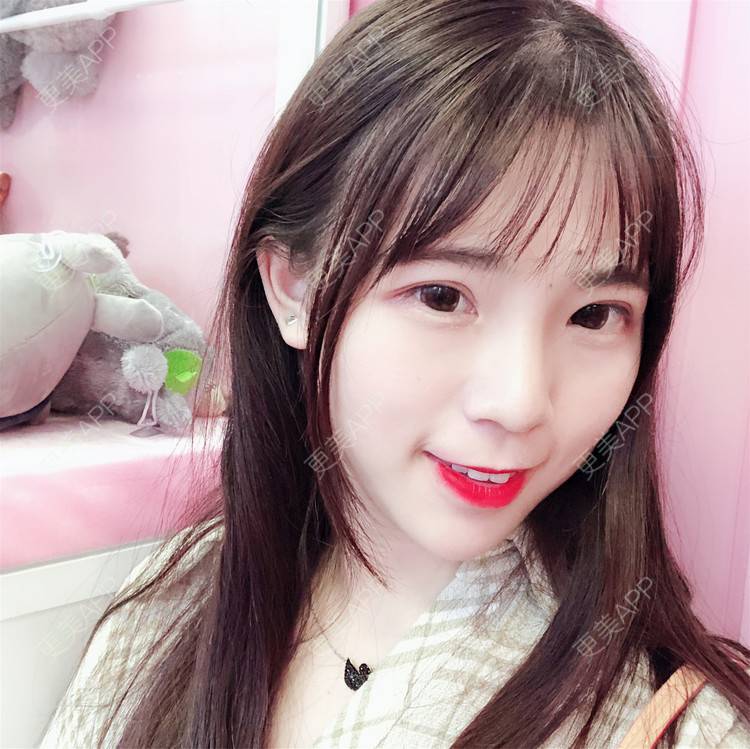 更美 - 叫我乖宝宝的鼻部多项经验 | 视频日记 | 鼻部多项 | 耳软骨隆鼻 | 硅胶隆鼻 | 南京 | 鼻部多项 | 南京