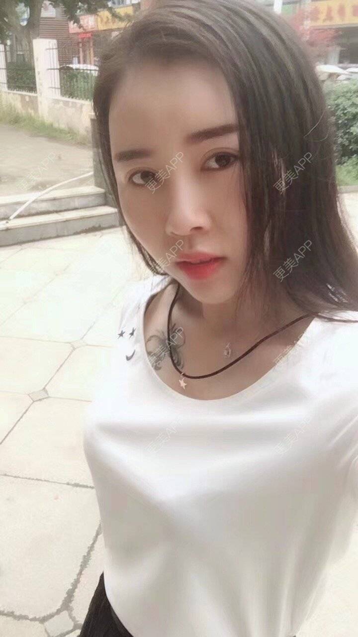 更美 - 更美用户X57YYq4efJ的鼻部多项经验 | 鼻形矫正 | 鹰钩鼻矫正 | 鼻部多项 | 南京