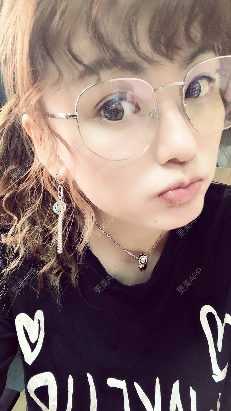 更美 - 更美用户lUU9ScnoEy的准分子激光切削术经验 | 全飞秒激光术 | 半飞秒激光术 | ICL晶体植入 | 准分子激光切削术 | 深圳