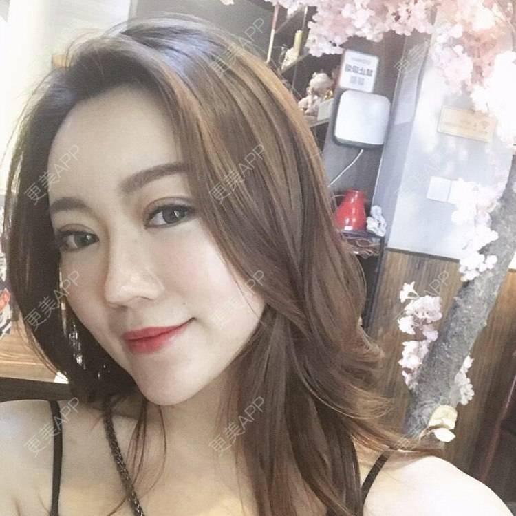 更美 - 身野心安稳压的自体脂肪填充颈纹经验 | 自体脂肪填充颈纹 | 长沙