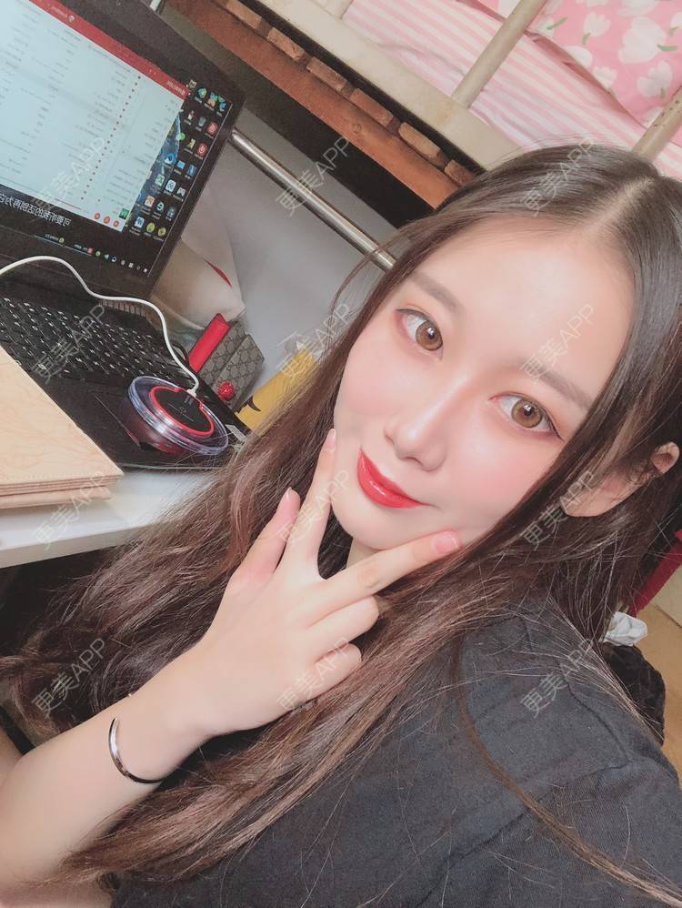 更美 - 更美用户V3kfqQBbsI的膨体垫下巴经验 | 上海 | 膨体垫下巴