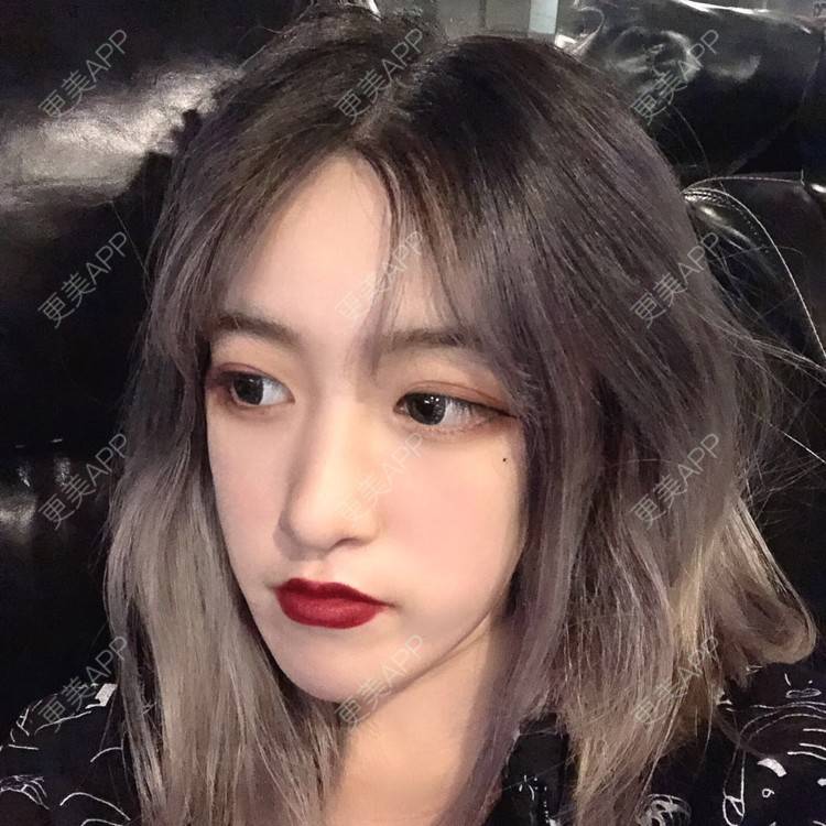 更美 - 更美用户5LnnwSf1yf的鼻部多项经验 | 中山 | 鼻部多项