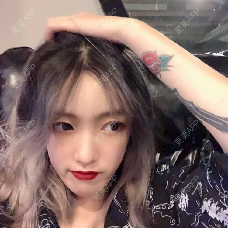 更美 - 更美用户5LnnwSf1yf的鼻部多项经验 | 中山 | 鼻部多项