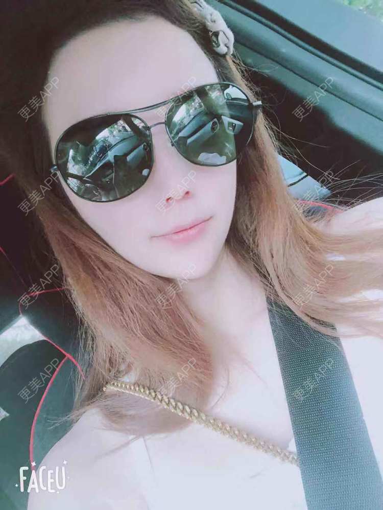 更美 - 更美用户EWqDuvHmIb的自体脂肪丰面颊经验 | 自体脂肪丰面颊 | 成都