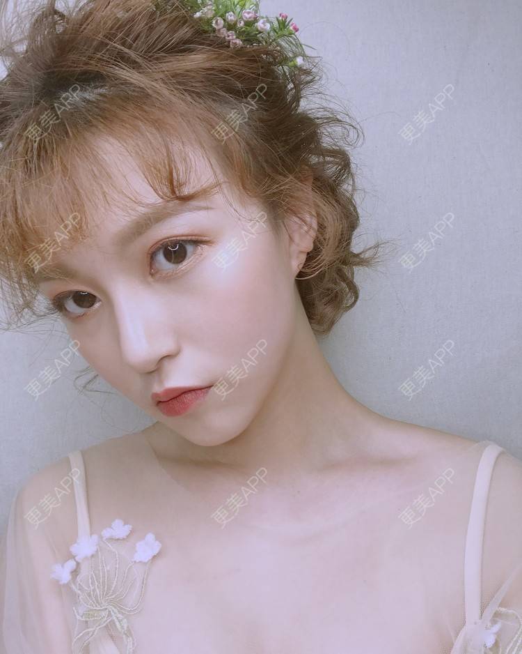 更美 - 猫忘了鱼尾纱丶的隆鼻经验 | 隆鼻 | 厦门