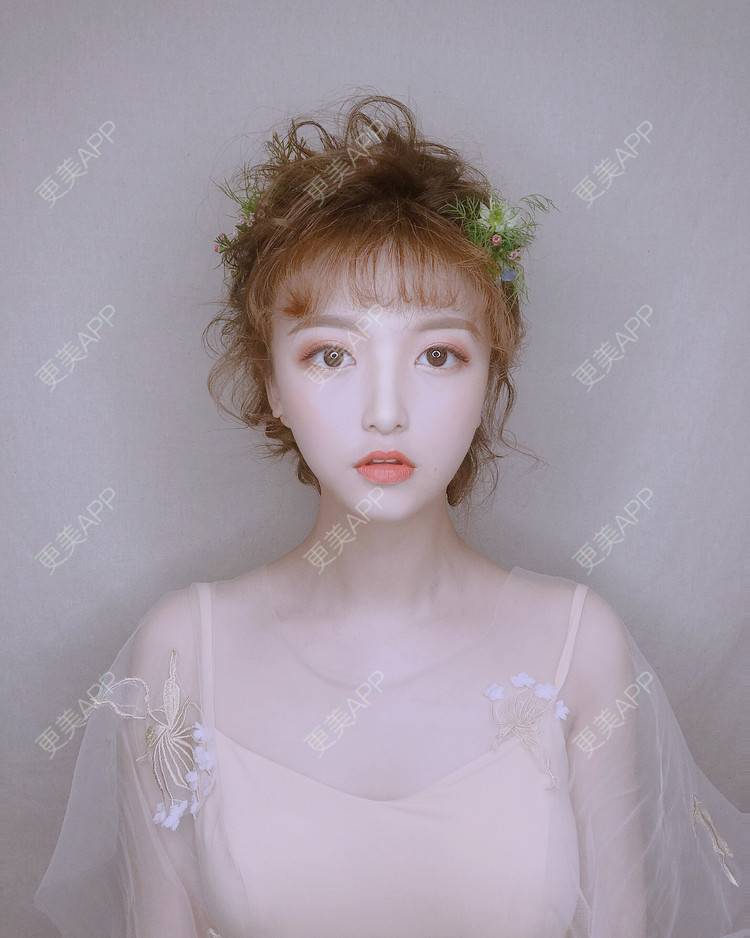 更美 - 猫忘了鱼尾纱丶的隆鼻经验 | 隆鼻 | 厦门