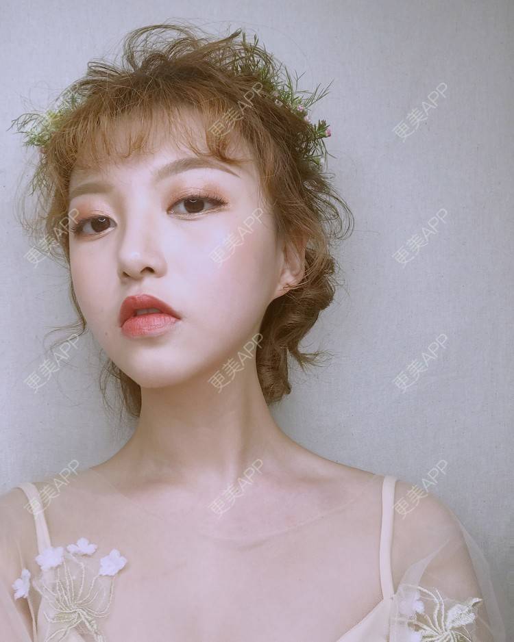 更美 - 猫忘了鱼尾纱丶的隆鼻经验 | 隆鼻 | 厦门