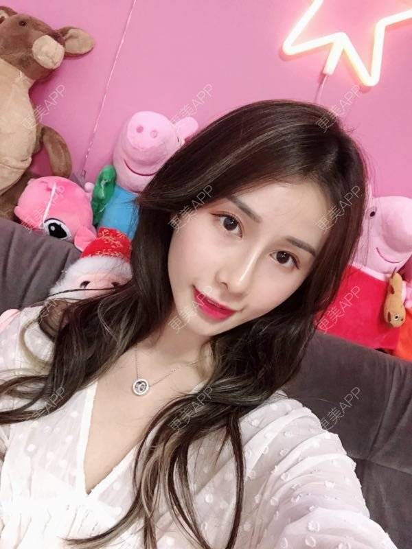 更美 - 七彩百香柠檬茶的鼻部多项经验 | 鼻小柱延长 | 自体软骨垫鼻尖 | 鼻部多项 | 重庆 | 硅胶隆鼻 | 肋软骨隆鼻 | 鼻翼缩小