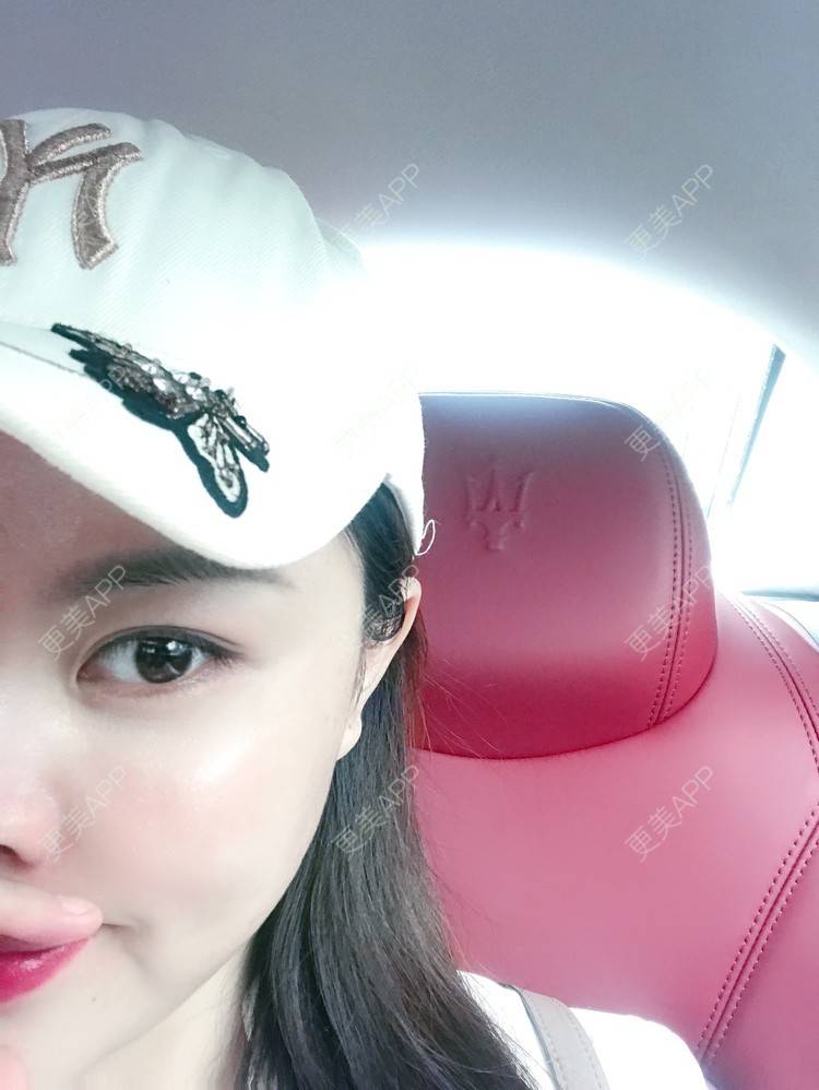 更美 - 小仙女诗雯的激光紧缩阴道经验 | 激光紧缩阴道