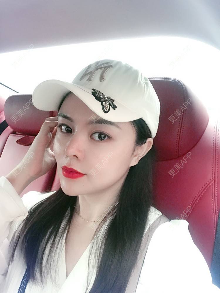 更美 - 小仙女诗雯的激光紧缩阴道经验 | 激光紧缩阴道