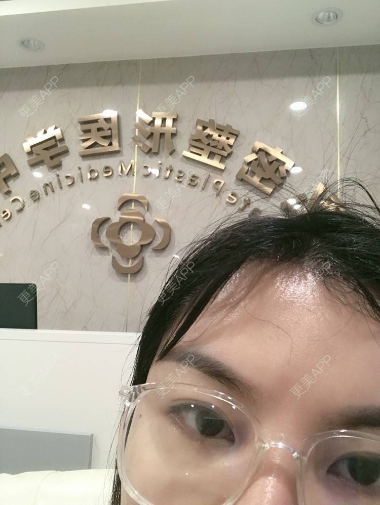 更美 - 小仙女诗雯的激光紧缩阴道经验 | 激光紧缩阴道