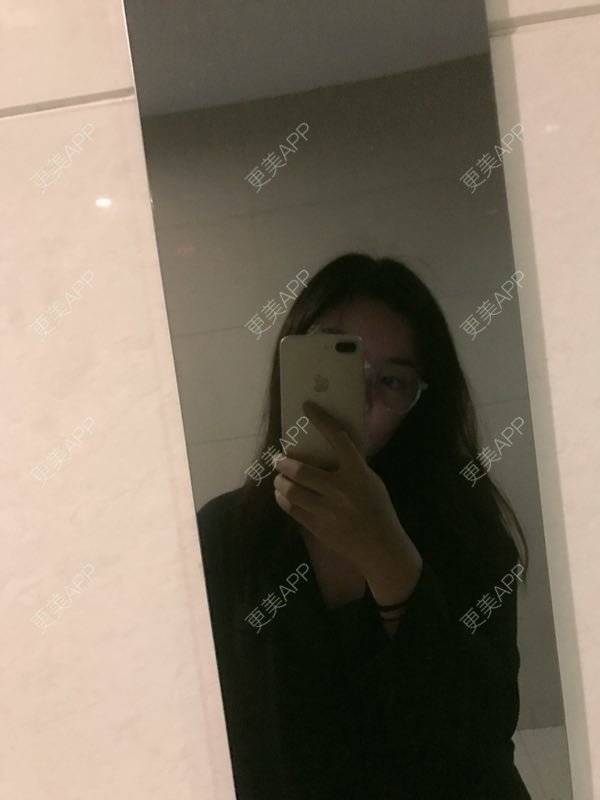 更美 - 小仙女诗雯的激光紧缩阴道经验 | 激光紧缩阴道