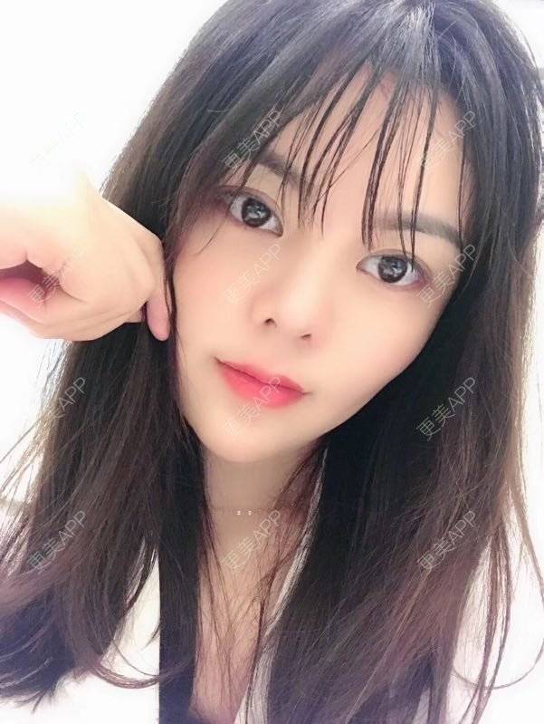 更美 - 小仙女诗雯的激光紧缩阴道经验 | 激光紧缩阴道