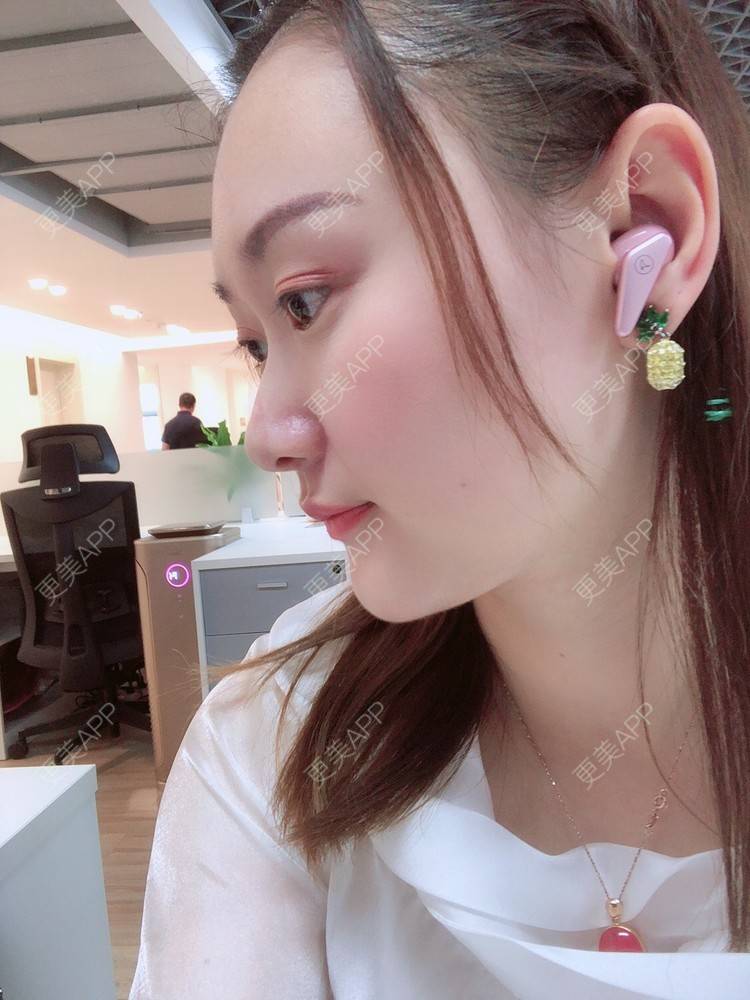 更美 - 小魅力的下巴经验 | 缩下巴 | 硅胶垫下巴 | 膨体垫下巴 | 宽下巴矫正 | 下巴 | 玻尿酸下巴 | 下巴截骨前移 | 自体脂肪垫下巴 | 人工骨垫下巴