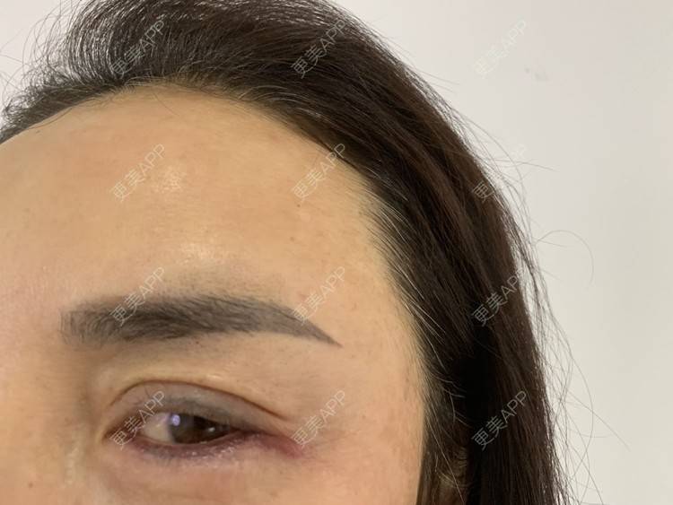更美 - 更美用户APiVTo0HWJ的洗眼线经验 | 洗眼线 | 郑州