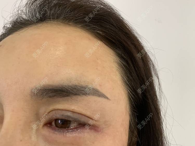更美 - 更美用户APiVTo0HWJ的洗眼线经验 | 洗眼线 | 郑州