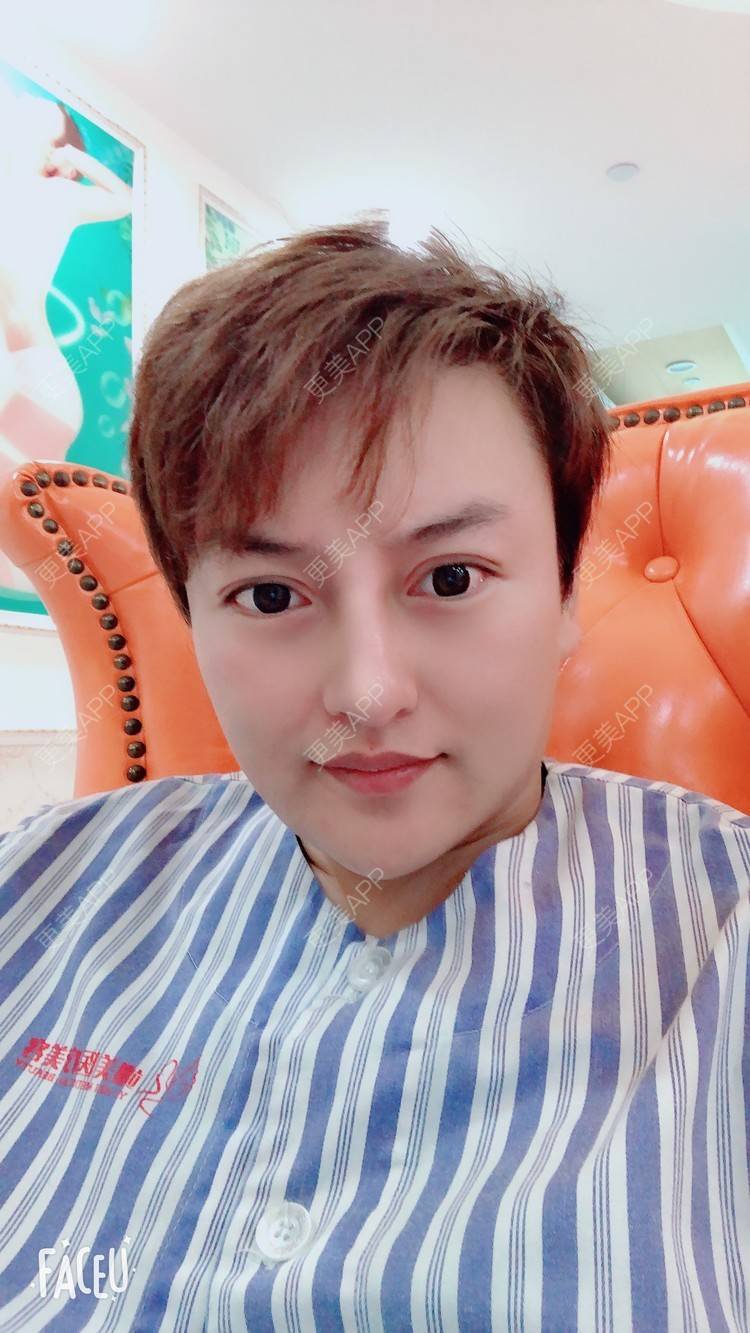 更美 - 杰教授的鼻形态修复经验 | 广州 | 鼻形态修复