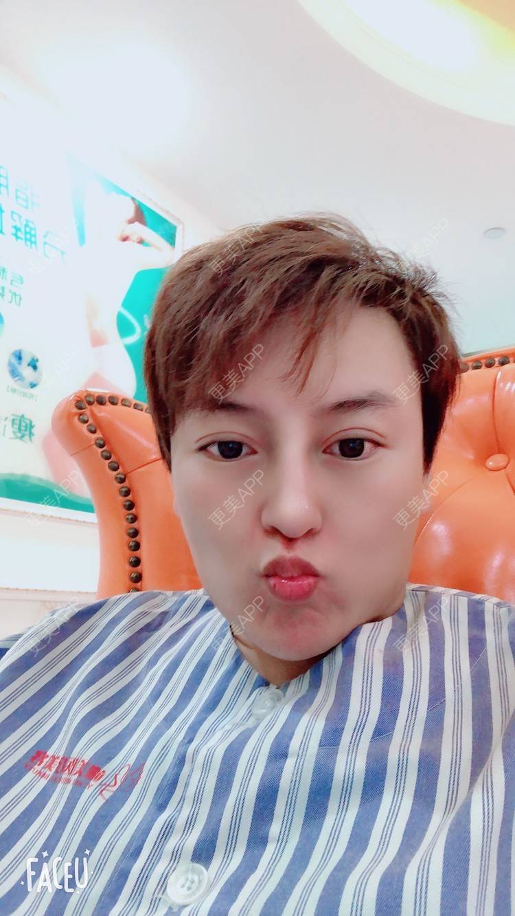 更美 - 杰教授的鼻形态修复经验 | 广州 | 鼻形态修复