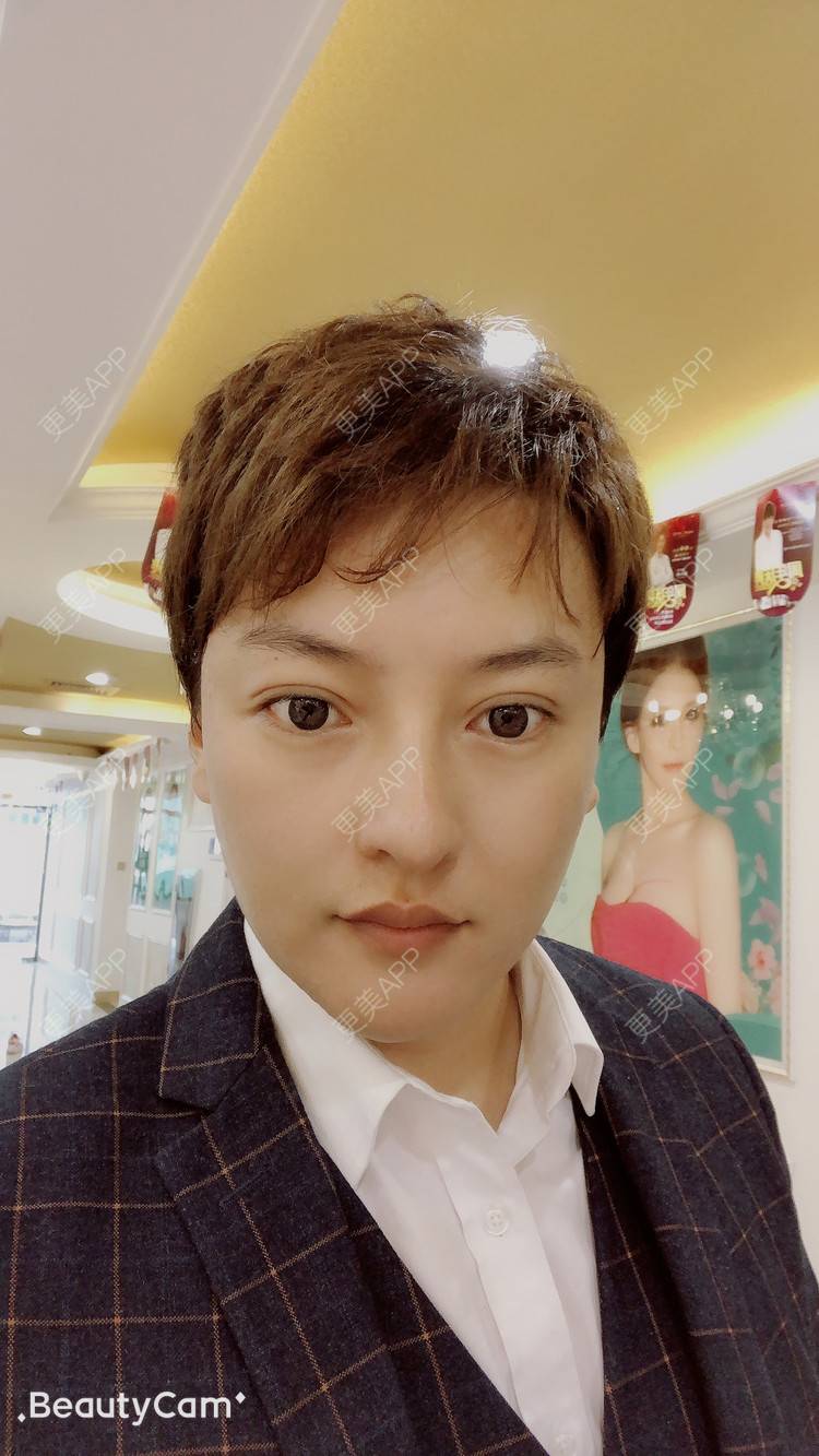 更美 - 杰教授的鼻形态修复经验 | 广州 | 鼻形态修复