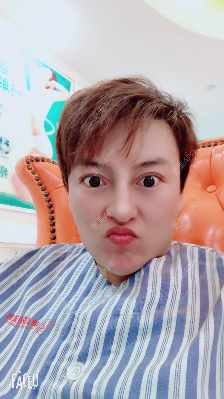 更美 - 杰教授的鼻形态修复经验 | 广州 | 鼻形态修复