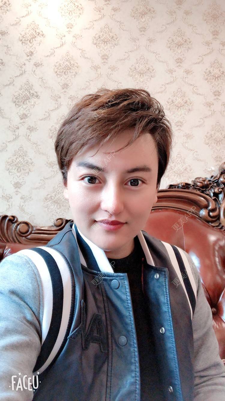 更美 - 杰教授的鼻形态修复经验 | 广州 | 鼻形态修复