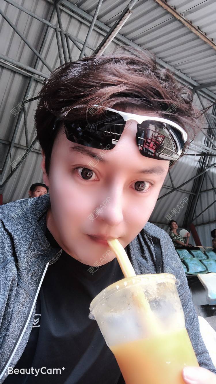 更美 - 杰教授的鼻形态修复经验 | 广州 | 鼻形态修复