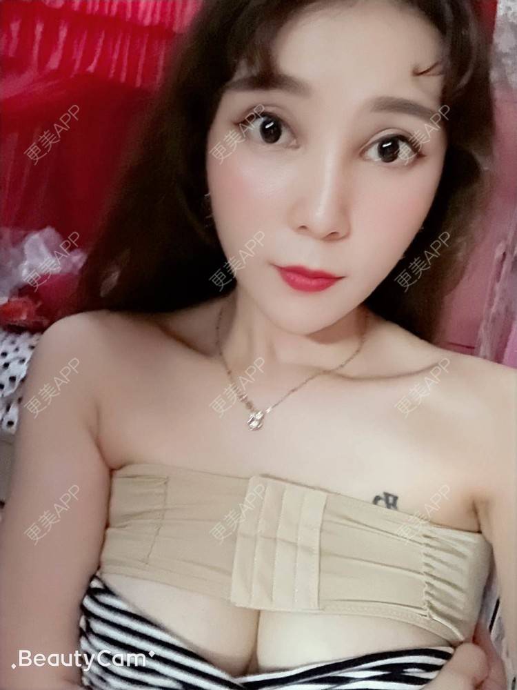 更美 - 穆大力 医生的假体隆胸经验 | 假体隆胸 | 广州