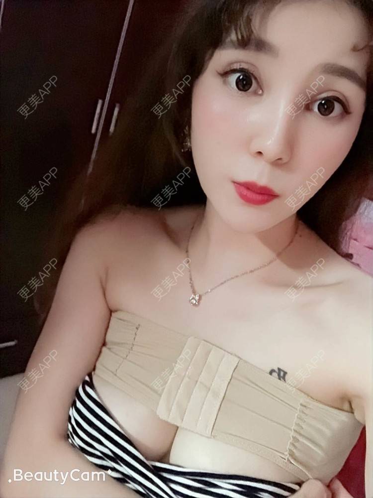 更美 - 穆大力 医生的假体隆胸经验 | 假体隆胸 | 广州