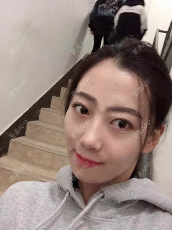 更美 - 更美用户rhLssoIYeR的热玛吉经验 | 超声提升 | 热拉提 | 深圳 | 热玛吉