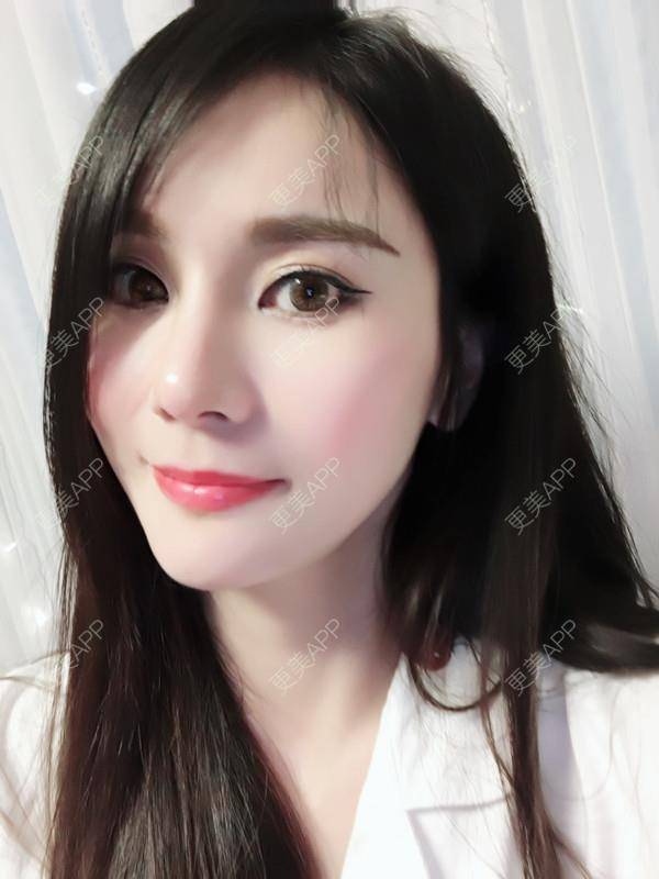 更美 - 肉圆子的酒窝经验 | 膨体垫下巴 | 自体脂肪垫下巴 | 硅胶垫下巴 | 人工骨垫下巴 | 酒窝 | 下巴 | 玻尿酸下巴 | 下巴截骨前移 | 酒窝成形 | 重庆 | 胶原蛋白丰下巴