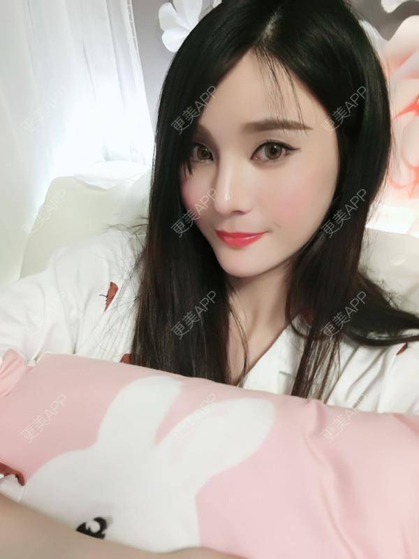 更美 - 肉圆子的酒窝经验 | 膨体垫下巴 | 自体脂肪垫下巴 | 硅胶垫下巴 | 人工骨垫下巴 | 酒窝 | 下巴 | 玻尿酸下巴 | 下巴截骨前移 | 酒窝成形 | 重庆 | 胶原蛋白丰下巴