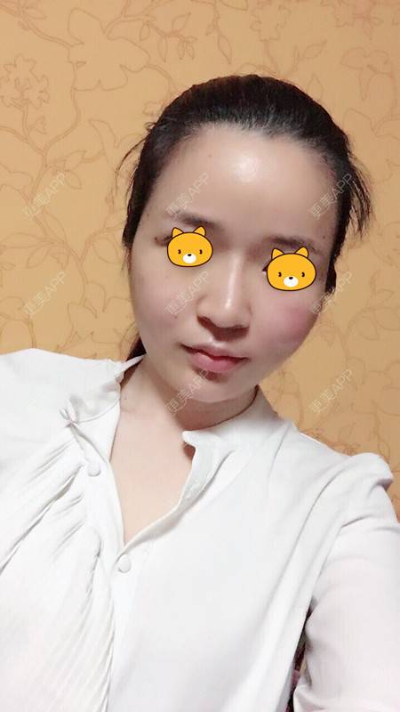 更美 - 更美用户5evM74gxsd的舒敏之星经验 | 舒敏之星