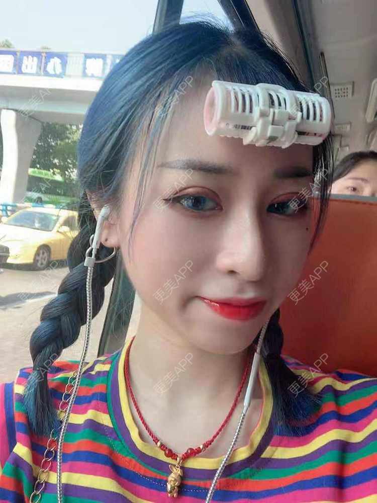 更美 - 饭冰冰儿的鼻部多项经验 | 鼻部多项 | 硅胶隆鼻 | 鹰钩鼻矫正 | 肋软骨隆鼻 | 鼻翼缩小